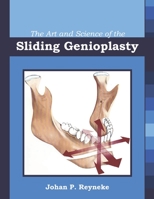 The Art and Science of the Sliding Genioplasty 1948083132 Book Cover