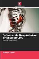 Quimioembolização intra-arterial do CHC 6206325172 Book Cover