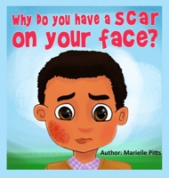 Why do you have a scar on your face? 0578509938 Book Cover