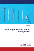 White Spot Lesions and its Management 3330352787 Book Cover