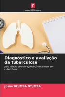 Diagnóstico e avaliação da tuberculose (Portuguese Edition) 6208624363 Book Cover