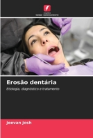 Erosão dentária: Etiologia, diagnóstico e tratamento (Portuguese Edition) 6207009592 Book Cover
