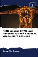 Pcnl против Eswl для лечения кам
 6205345552 Book Cover