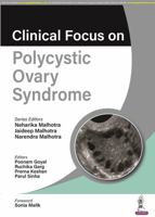 Clinical Focus on Polycystic Ovary Syndrome 9356960917 Book Cover