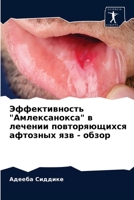 Эффективность "Амлексанокса" в лечении повторяющихся афтозных язв - обзор 6203347914 Book Cover