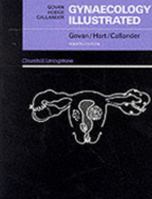 Gynecology Illustrated 0443047995 Book Cover