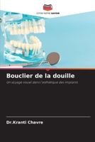 Bouclier de la douille (French Edition) 6209873650 Book Cover