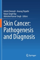 Skin Cancer: Pathogenesis and Diagnosis 9811603634 Book Cover