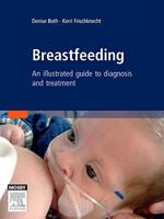 Breastfeeding: An Illustrated Guide To Diagnosis and Treatment 0729538885 Book Cover