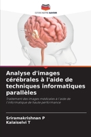 Analyse d'images cérébrales à l'aide de techniques informatiques parallèles 6207281136 Book Cover