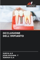 Occlusione Dell'impianto (Italian Edition) 6207931688 Book Cover