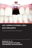 Les Complications Liées Aux Implants (French Edition) 6207122038 Book Cover