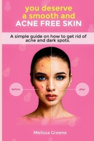 you deserve a smooth and acne free skin: a simple guide on how to get rid of acne B0CNL6T9LK Book Cover