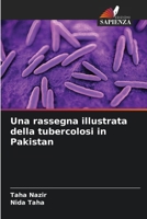 Una rassegna illustrata della tubercolosi in Pakistan (Italian Edition) 6208599695 Book Cover
