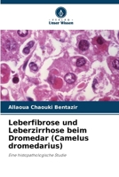 Leberfibrose und Leberzirrhose beim Dromedar (Camelus dromedarius) (German Edition) 6209957919 Book Cover