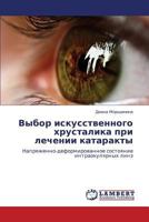 Выбор искусственного хрусталика при лечении катаракты: Напряженно-деформированное состояние интраокулярных линз 3844357009 Book Cover