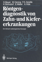 Röntgendiagnostik Von Zahn Und Kiefererkrankungen: Ein Klinisch Radiologisches Konzept 3642710646 Book Cover