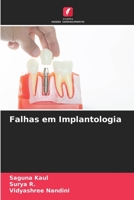 Falhas em Implantologia 6206307034 Book Cover