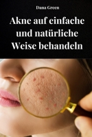 AKNE AUF EINFACHE UND NATÜRLICHE WEISE BEHANDELN: Wie man Akne behandelt, indem man unseren Körper reinigt und ausschließlich natürliche Heilmittel einsetzt (German Edition) B0FD2MF4N2 Book Cover