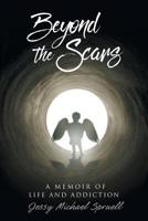 Beyond the Scars: A Memoir of Life and Addiction 1644627124 Book Cover