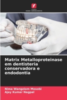 Matrix Metalloproteinase em dentisteria conservadora e endodontia (Portuguese Edition) 6207928466 Book Cover