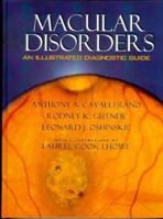 Macular Disorders: An Illustrated Diagnostic Guide 0750692243 Book Cover
