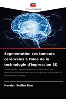 Segmentation des tumeurs cérébrales à l'aide de la technologie d'impression 3D 620405953X Book Cover