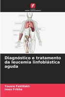 Diagnóstico e tratamento da leucemia linfoblástica aguda (Portuguese Edition) 6208184932 Book Cover