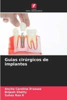Guias cirúrgicos de implantes (Portuguese Edition) 6208075718 Book Cover