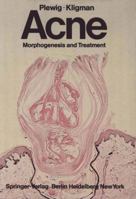 Acne: Morphogenesis and Treatment 3642962475 Book Cover