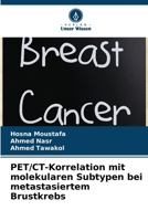 PET/CT-Korrelation mit molekularen Subtypen bei metastasiertem Brustkrebs 6205618591 Book Cover
