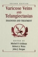 Varicose Veins and Telangiectasias: Diagnosis and Treatment 0942219449 Book Cover