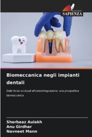 Biomeccanica negli impianti dentali (Italian Edition) 6630537238 Book Cover
