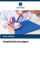 Implantatversagen 6206227960 Book Cover