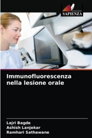 Immunofluorescenza nella lesione orale 6203242624 Book Cover