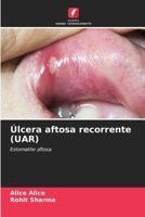 Úlcera aftosa recorrente (UAR) 6207419049 Book Cover