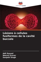 Lésions à cellules fusiformes de la cavité buccale (French Edition) 6207163672 Book Cover