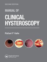 A Manual of Clinical Hysteroscopy 1842142593 Book Cover