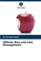 Offener Biss und sein Management 6204173650 Book Cover