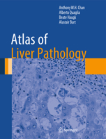 Atlas of Liver Pathology 1461491134 Book Cover