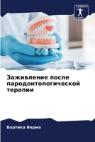 &#1047;&#1072;&#1078;&#1080;&#1074;&#1083;&#1077;&#1085;&#1080;&#1077; &#1087;&#1086;&#1089;&#1083;&#1077; &#1087;&#1072;&#1088;&#1086;&#1076;&#1086;& 6205728613 Book Cover