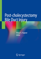 Post-cholecystectomy Bile Duct Injury 9811512353 Book Cover