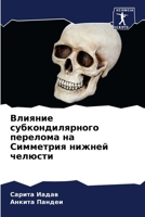Влияние субкондилярног&# 6207272676 Book Cover