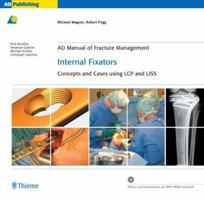 Internal Fixators: Concepts and Cases Using Lcp and Liss (Ao Manual of Fracture Management Series) 1588904865 Book Cover