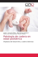 Patología de cadera en edad pediátrica 6203037915 Book Cover