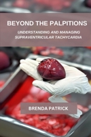 Beyond The palpitations: Understanding And Managing Supraventricular Tachycardia B0F1SDC4SW Book Cover