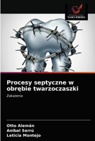 Procesy septyczne w obr&#281;bie twarzoczaszki 620338786X Book Cover