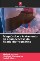 Diagnóstico e tratamento da equinococose do fígado diafragmático (Portuguese Edition) 6204552546 Book Cover