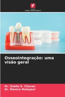 Osseointegração: uma visão geral 6206027562 Book Cover