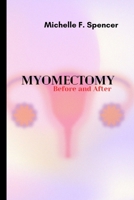 Myomectomy, before and after B0BW2K4C47 Book Cover